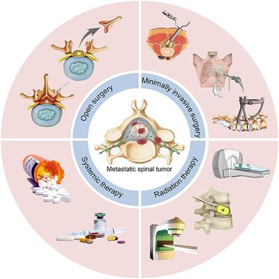 Clinical Therapy of Metastatic Spinal Tumors